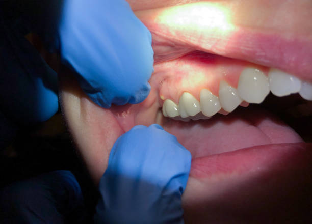 Best Pediatric Emergency Dentist in Thompsonville, CT