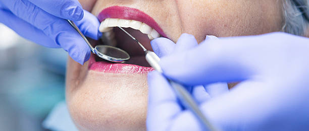 Best Emergency Treatment for Toothache in Thompsonville, CT